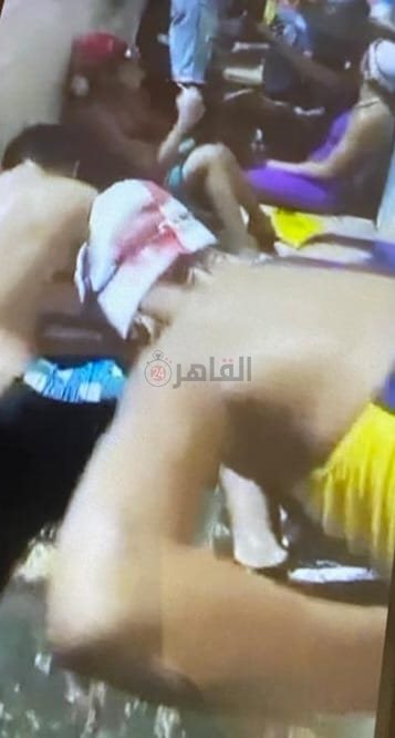 حالات اختناق في حمام سباحة بأحد نوادي الإسكندرية 