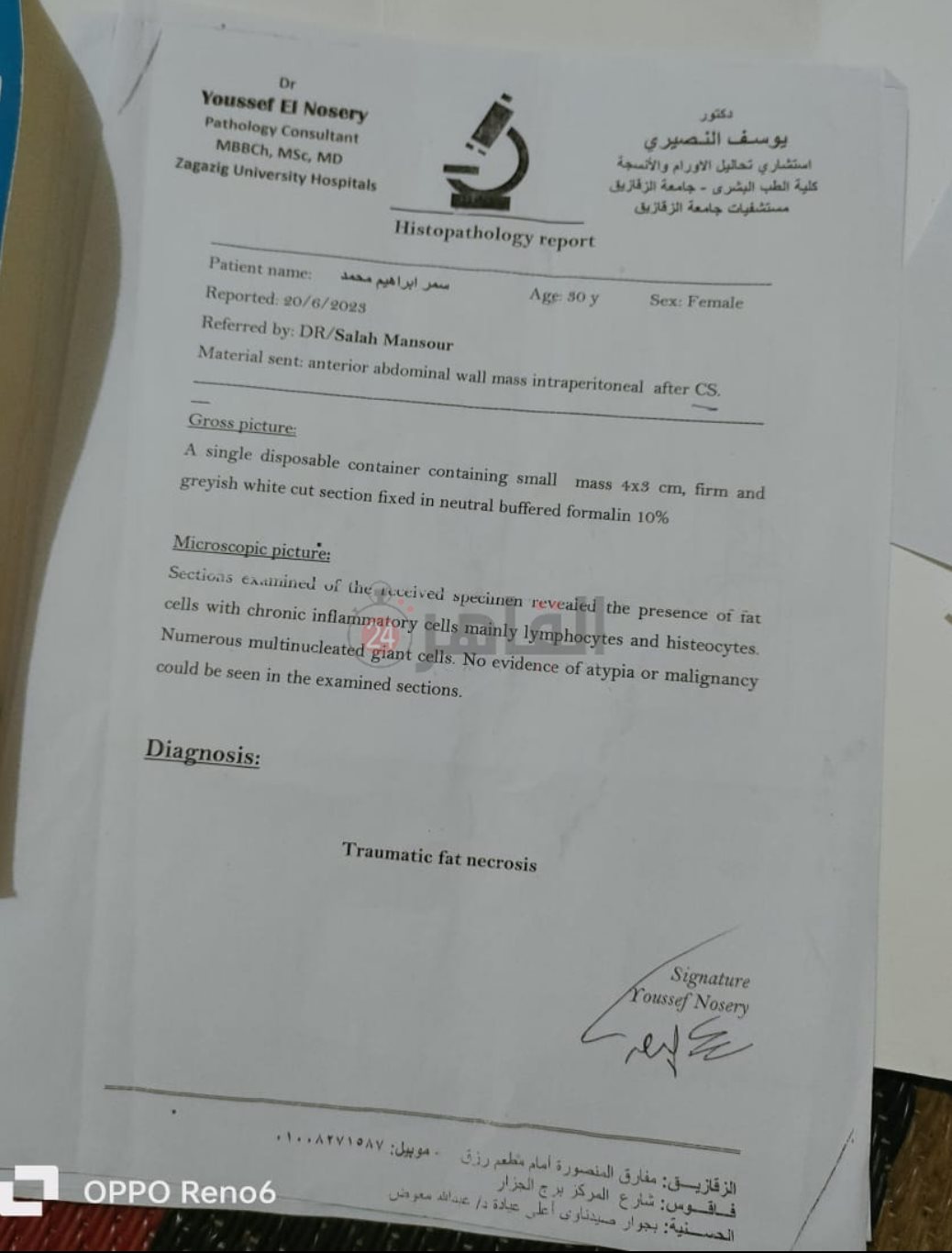 أحد التقارير