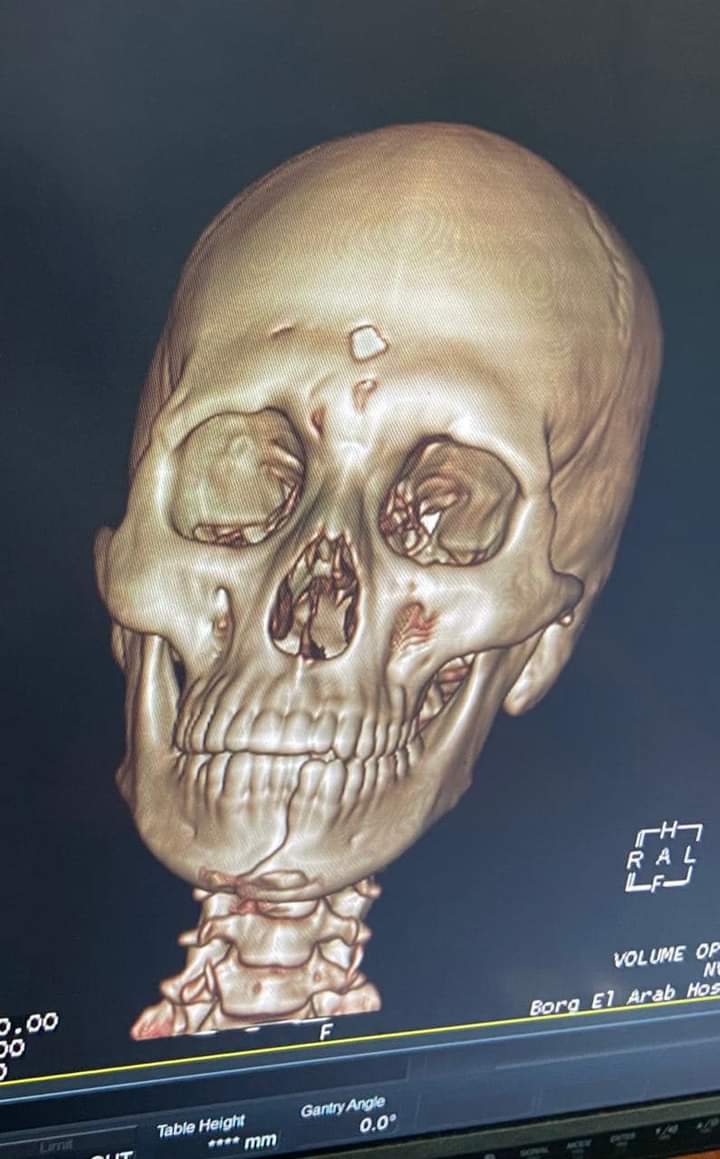 FB_IMG_1695086923429