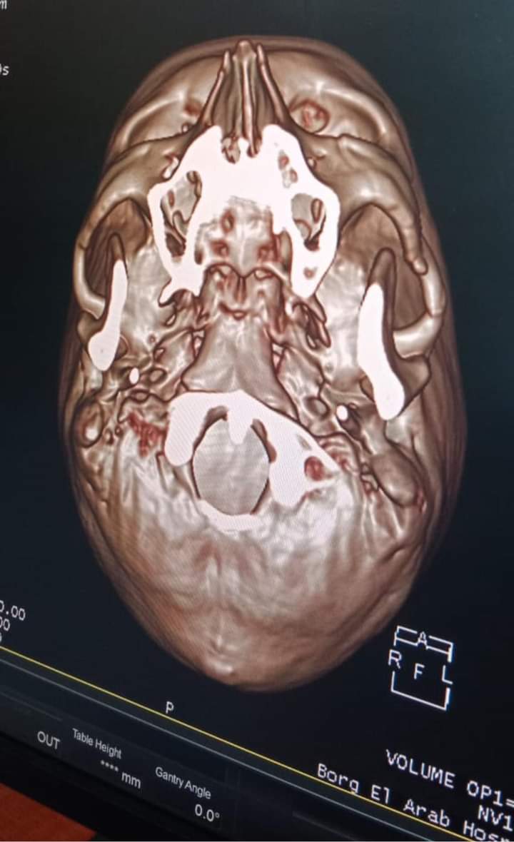 FB_IMG_1695086915458