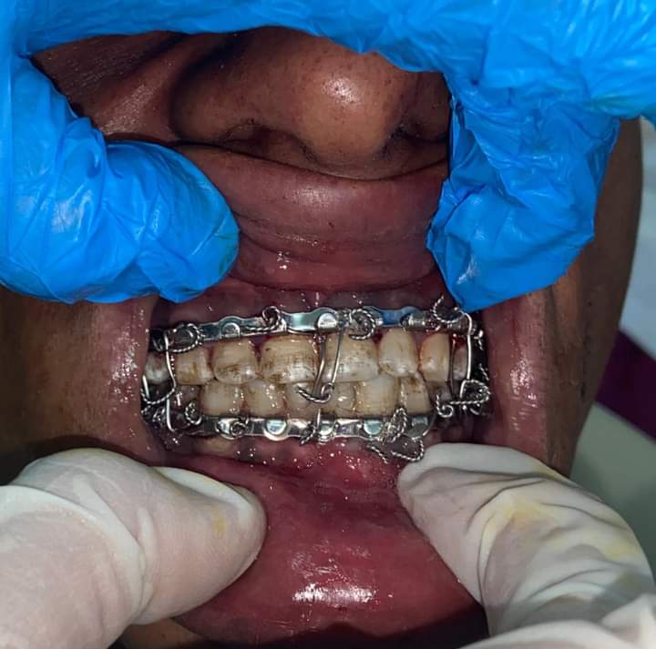 FB_IMG_1695086911447