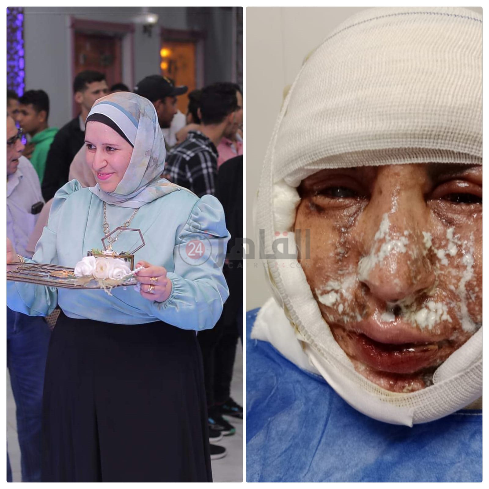 الزوجة المجني عليها قبل وبعد الشروع في قتلها