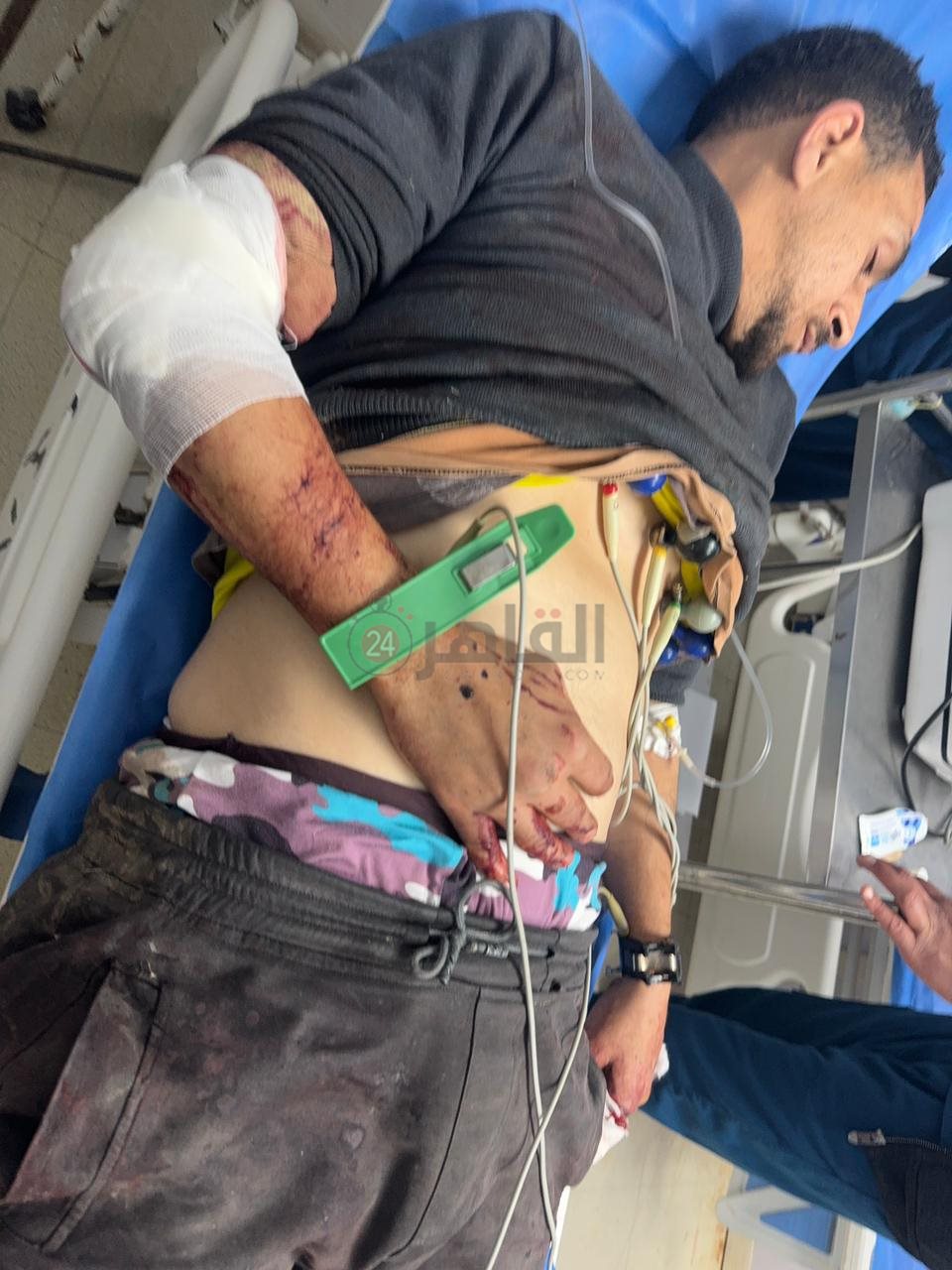 إصابة شخص بجروح قطعية في مشاجرة بالفيوم