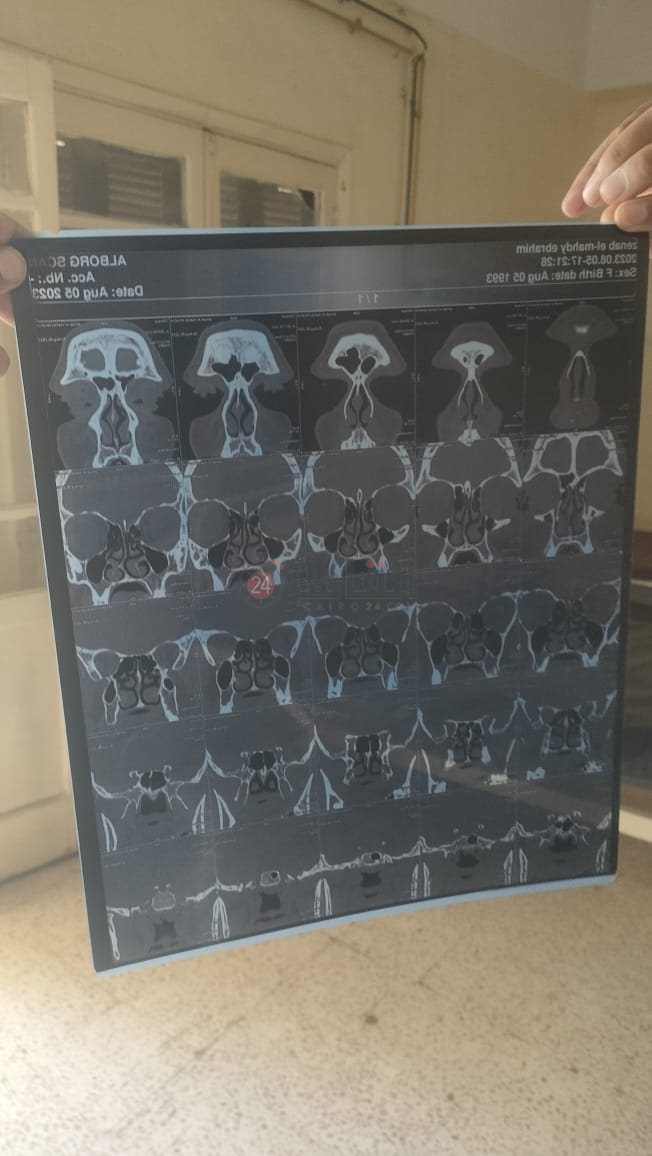 أشعة توضح خطورة حالة العم جلال 01