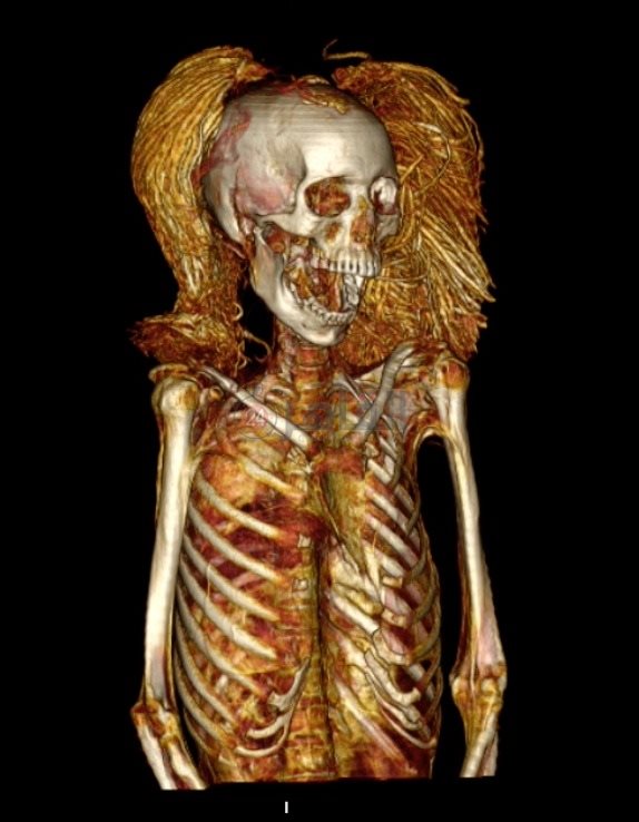 فم واسنان مومياء المرأة الصارخة (1)