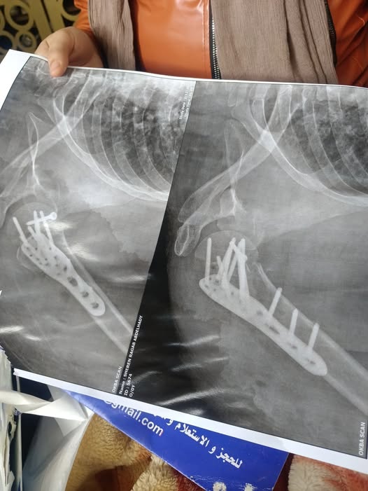 سيدة تتعرض لإصابات خطيرة بسبب زيادة أجرة التوكتوك