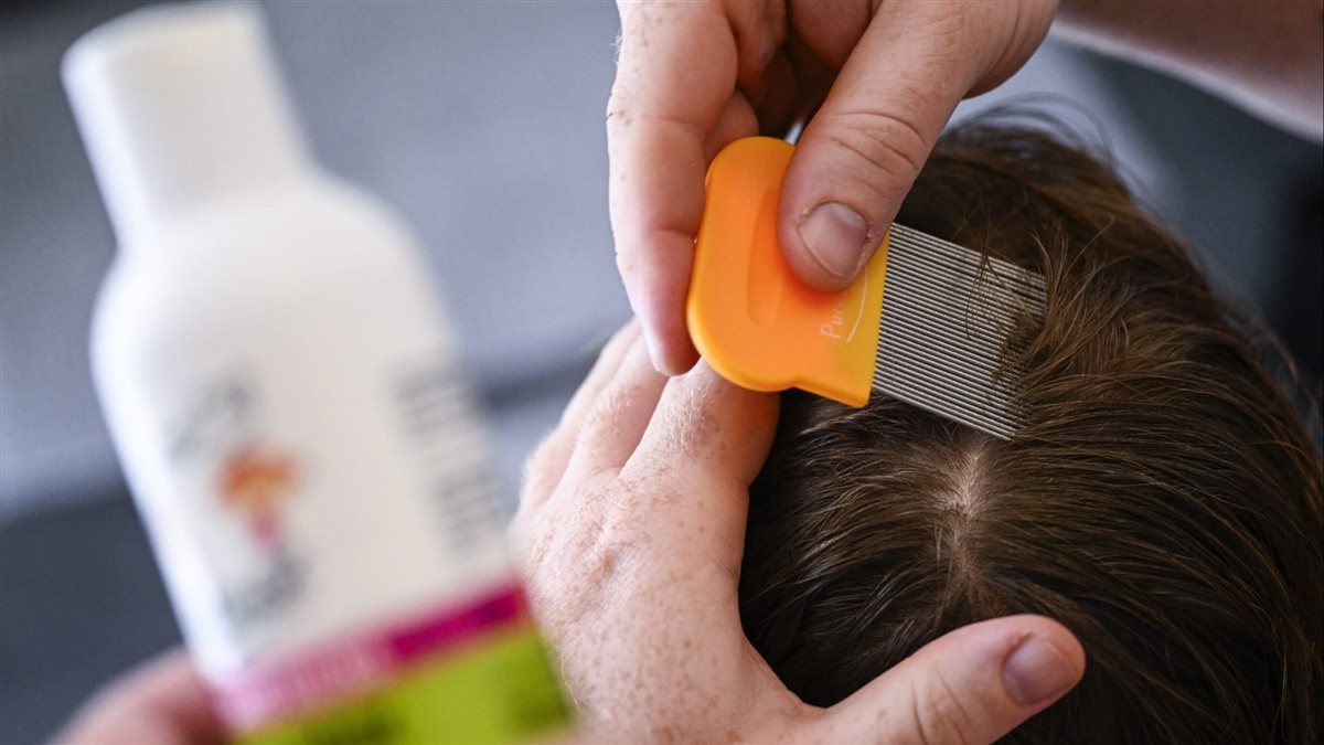 تفسير حلم نزع القمل من الشعر للمتزوجة