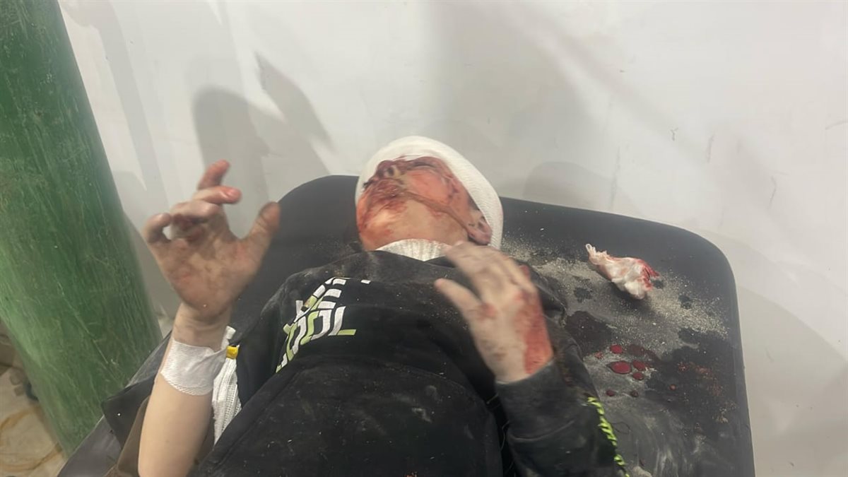 20 شهيدًا على الأقل وعشرات الإصابات في غارات شنتها طائرات الاحتلال على غزة