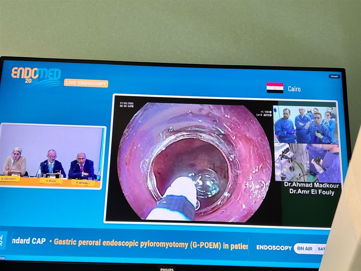  إجراء جراحة نادرة بمناظير الفراغ الثالث