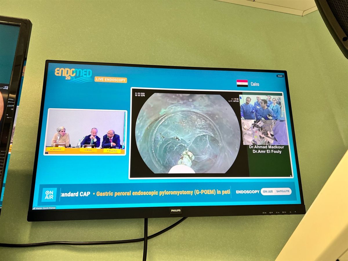  إجراء جراحة نادرة بمناظير الفراغ الثالث