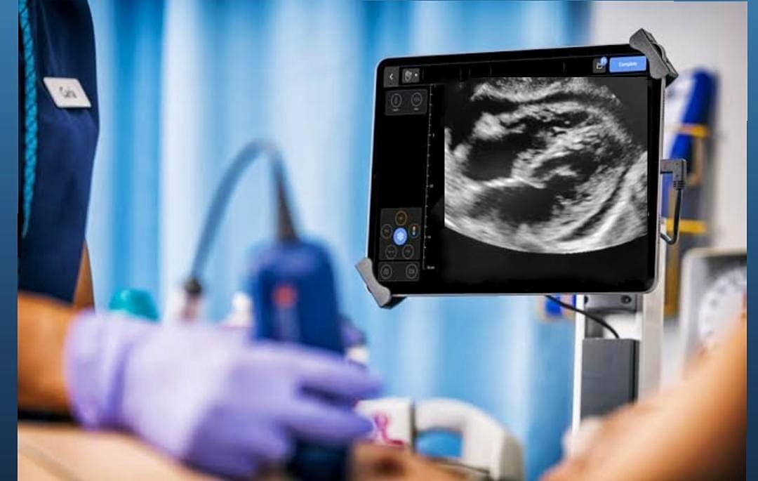 عملية دقيقة 