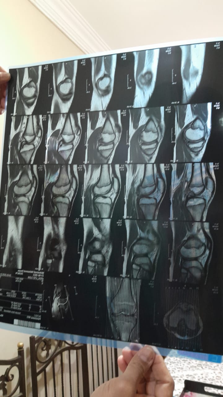 صورة أشعة الطفل