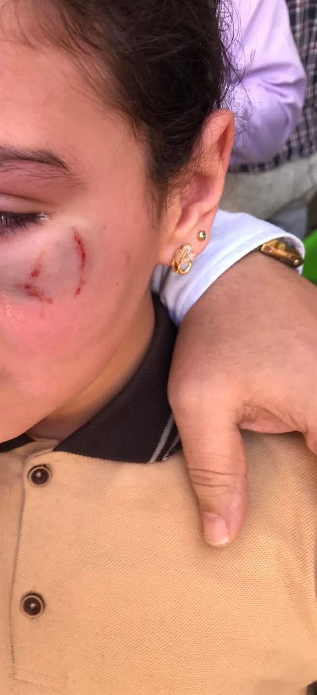 الطفلة المعتدي عليها