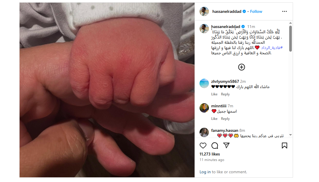 حسن الرداد وإيمي سمير غانم يرزقان بمولودة ويختاران لها اسم فادية