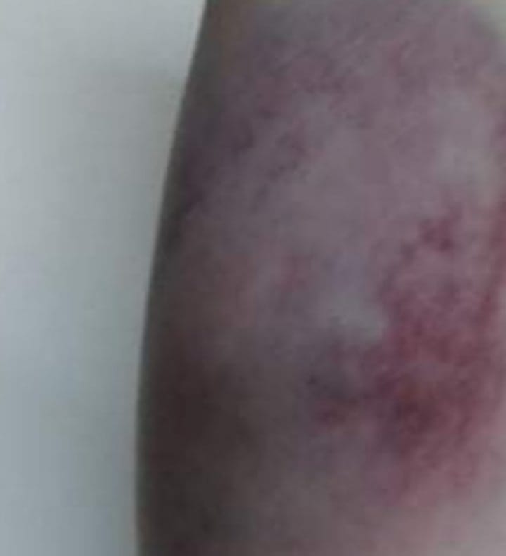 مقتنيات أية عادل مكسرة واسكرينات تهديد وعلامات تعذيب علي جسدها