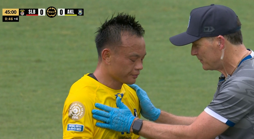 لاعب أوكلاند سيتي يرفض الخروج من مباراة بنفيكا بالرغم من إصابته