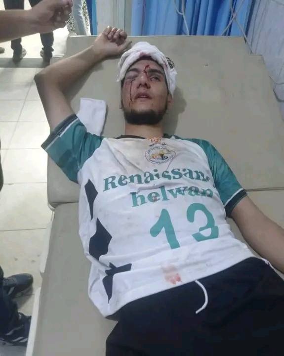 أحد المصابين