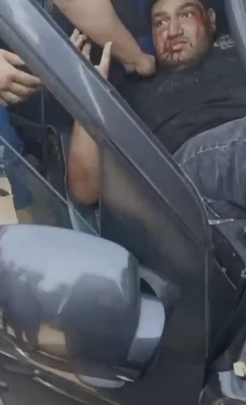 إصابة شخصين في حادث تصادم ملاكي بالتجمع