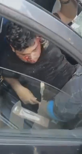 إصابة شخصين في حادث تصادم ملاكي بالتجمع