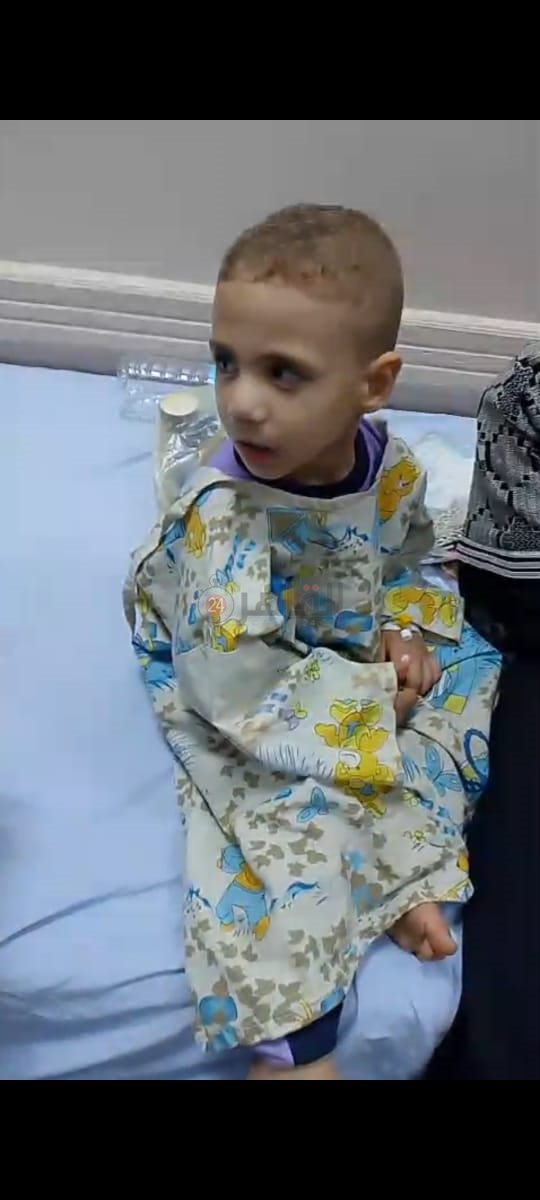 الصور الأولى لـ 5 صغار أصيبوا بتسمم بالمنيا (4)