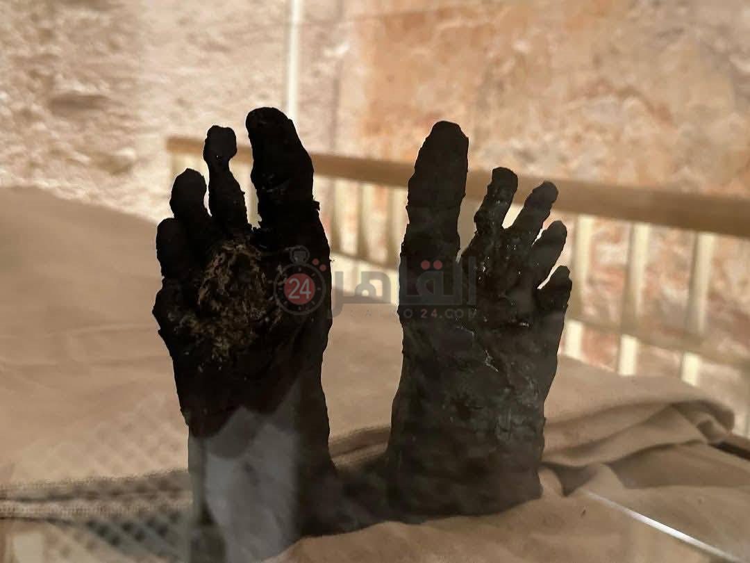 مومياء توت عنخ آمون بوادي الملوك بالأقصر (4)