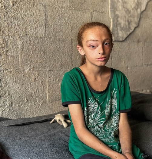 الطفلة سارة