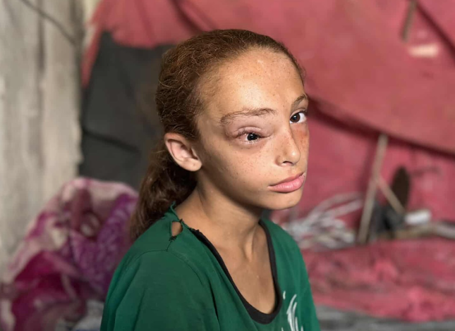 الطفلة سارة