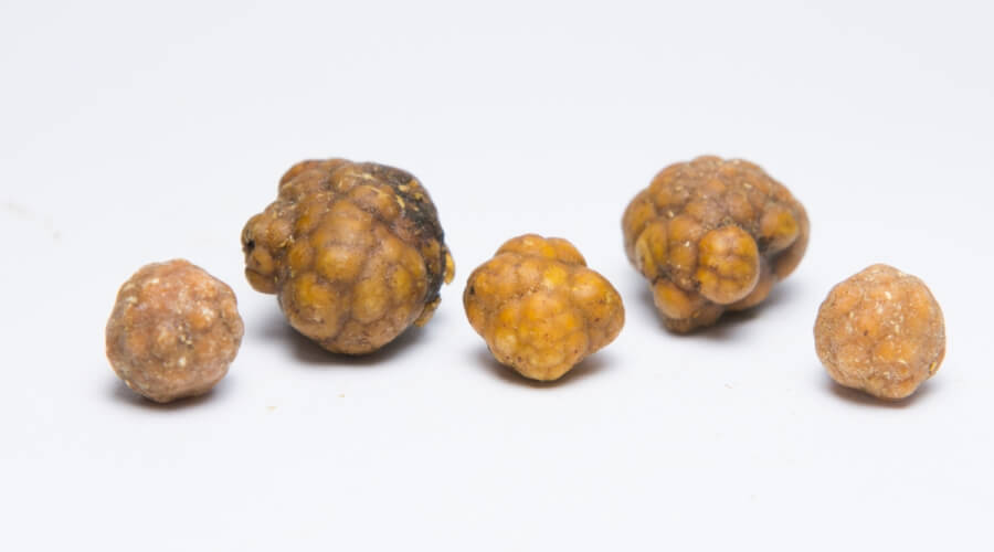 هل حصى المرارة يذوب؟