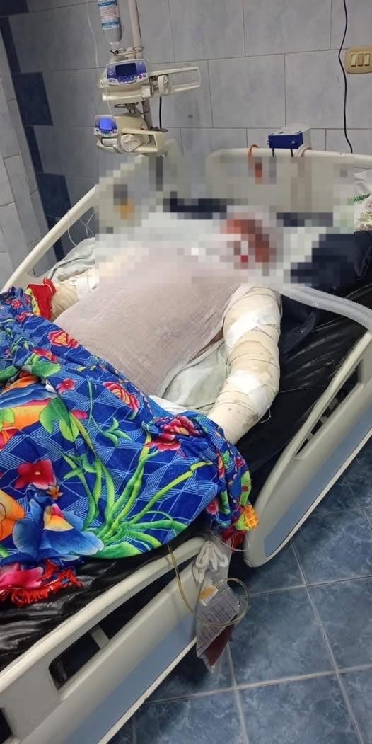 بطل حريق محطة مترو شبرا الخيمة