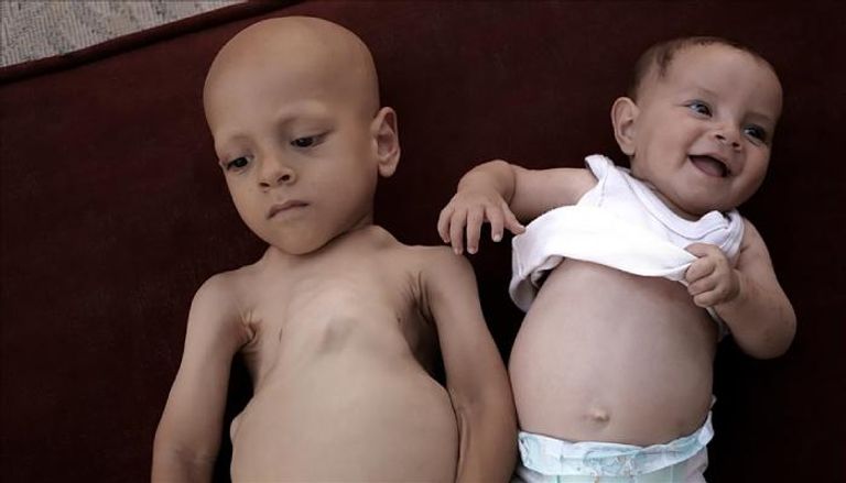 الطفل عبد الله أبو زرقة وشقيقته حبيبة شقيقة