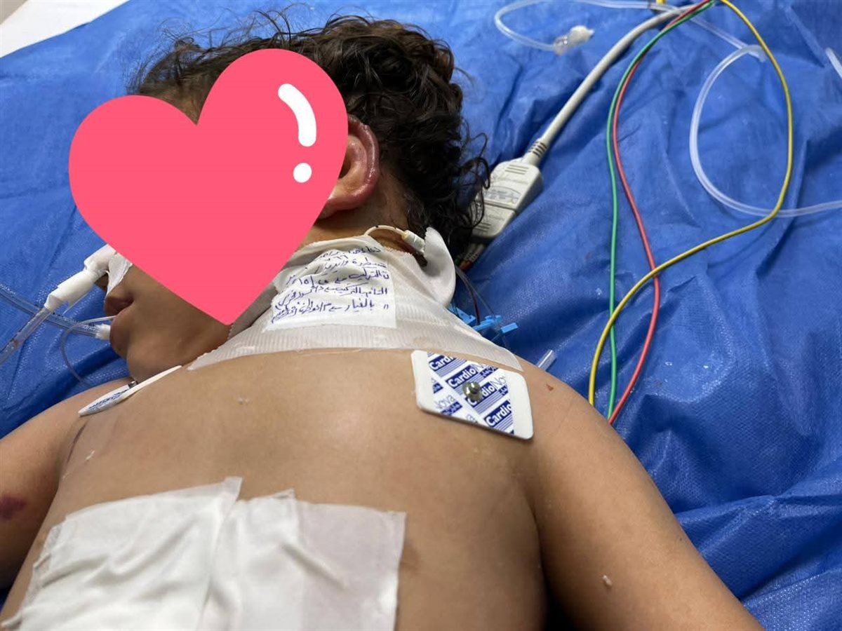 <strong>إنقاذ طفلة بعد سقوطها من علو بمستشفى بني عبيد التخصصي بالدقهلية</strong>