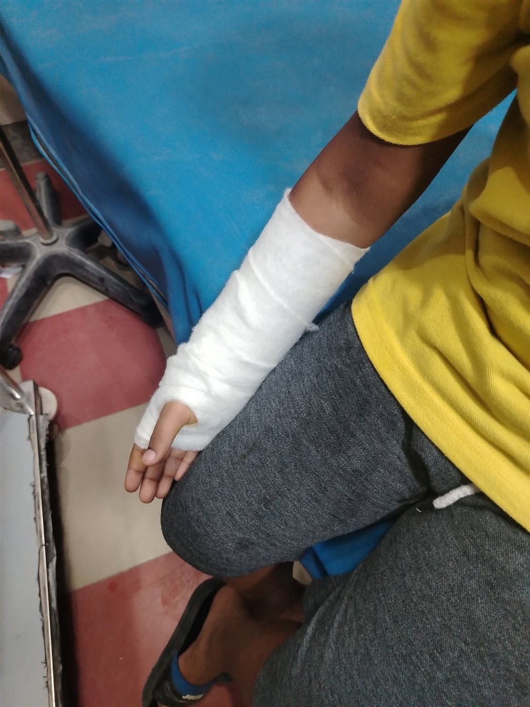 إصابة الطفل