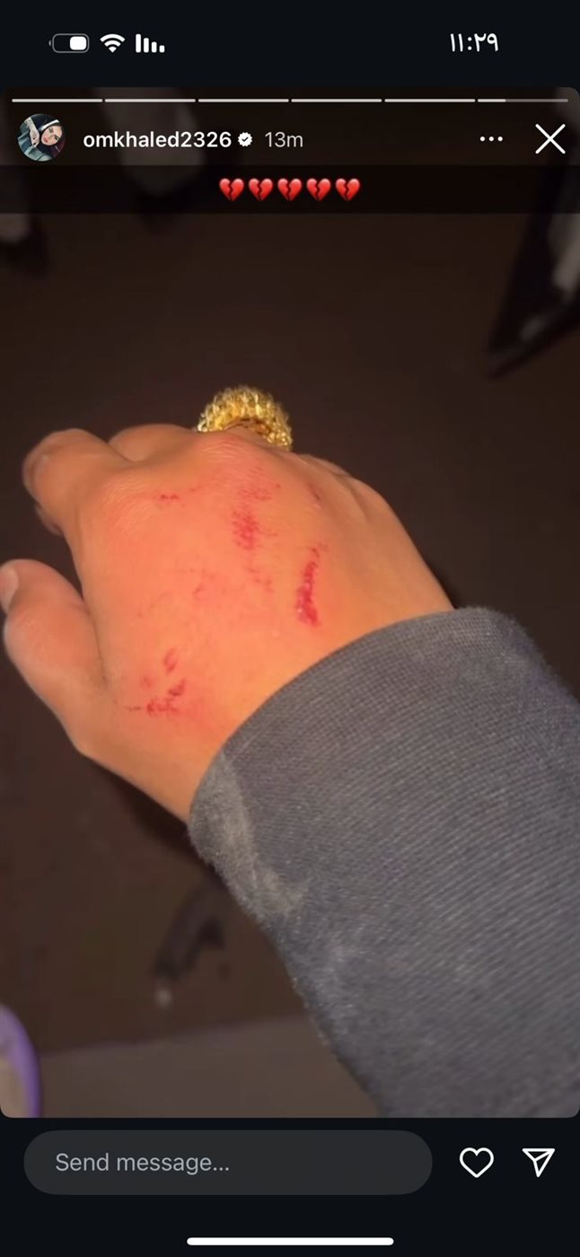 البلوجر أم خالد تتعرض لحادث سير