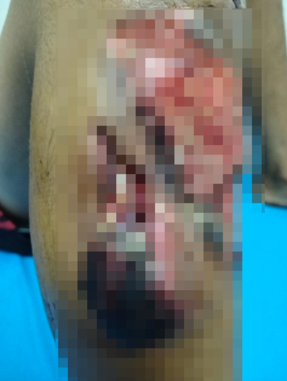  كلب شرس يعقر صغير في فخذه بالسلام 