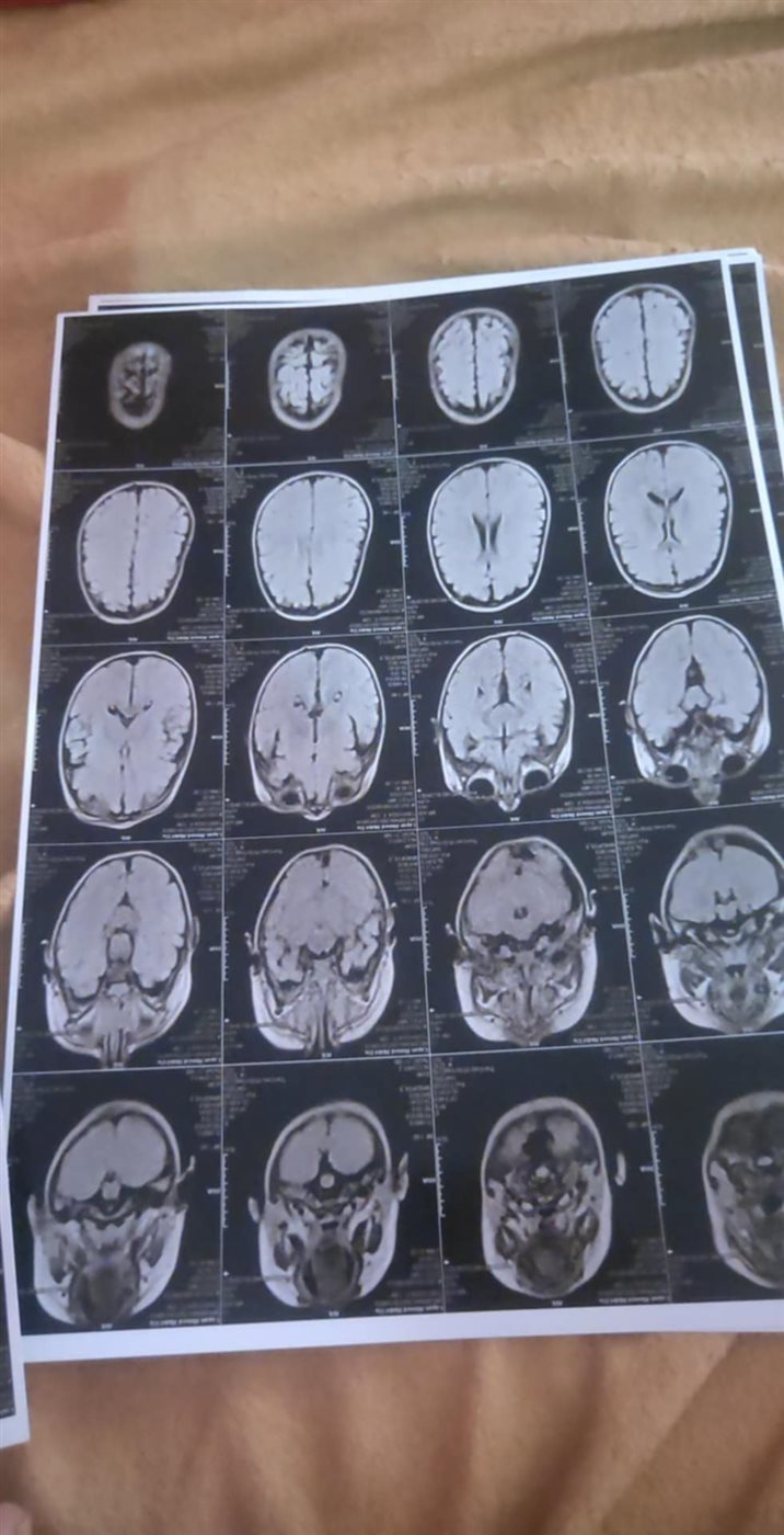 التقارير الطبية 