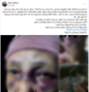 التعدي على مسنة بالقليوبية