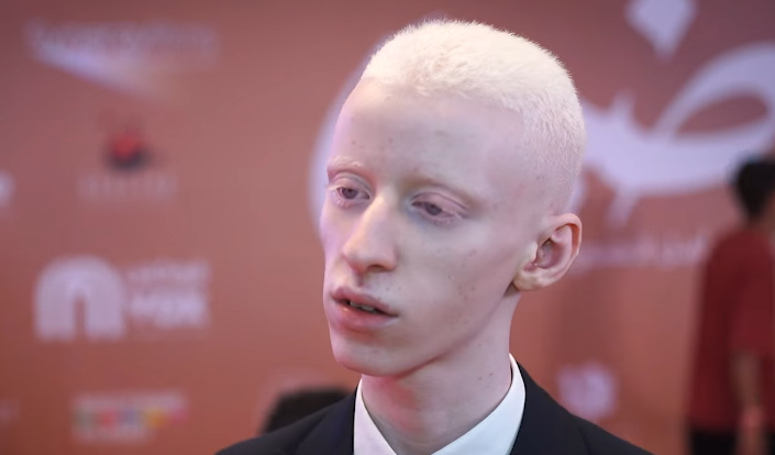 بطل فيلم ضي