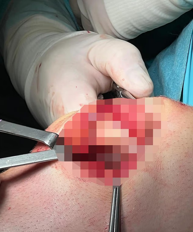 <strong>نجم توتنهام يثير الرعب في قلوب الجماهير بصورة مروعة</strong>