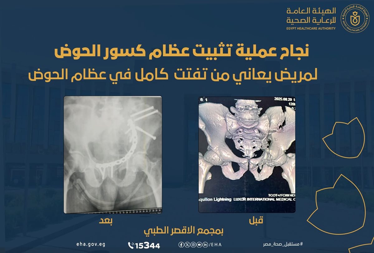 عملية ناجحة بالمجمع الطبي