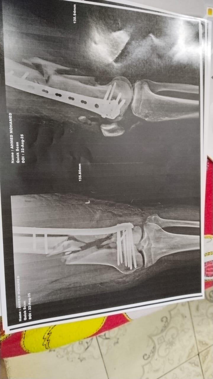 تقرير طبي لأحد مصابي حادث أسيوط 