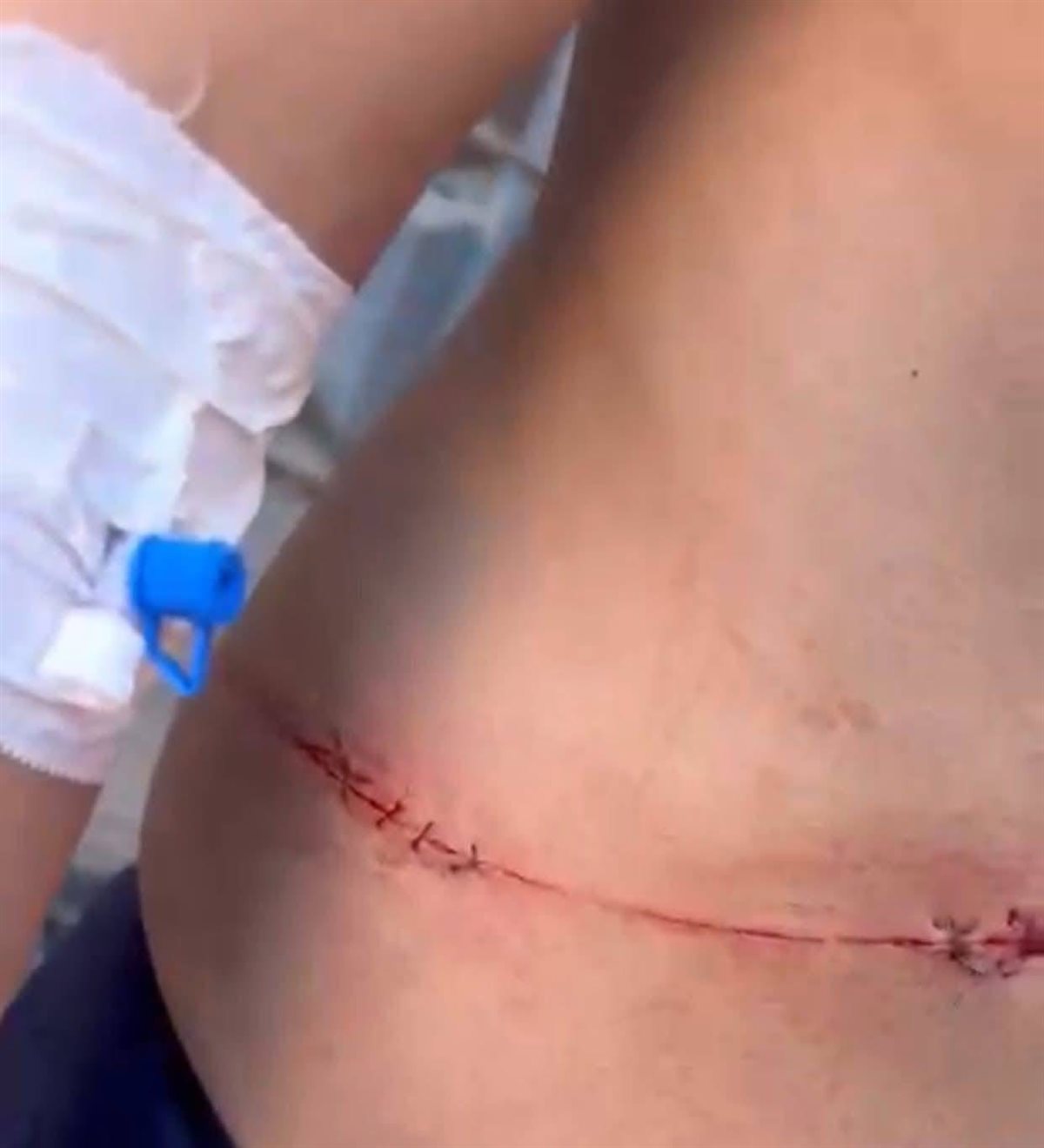 اعتداء 5 شباب على طالب ثانوي أمام مدرسته بالدقهلية&nbsp;