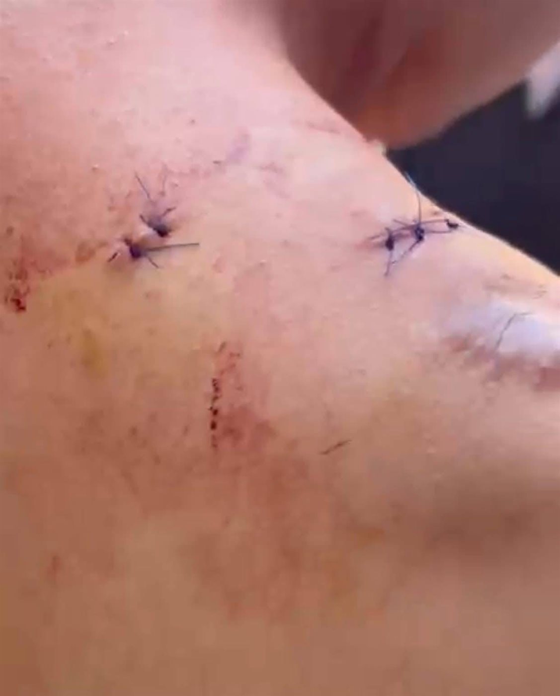 اعتداء 5 شباب على طالب ثانوي أمام مدرسته بالدقهلية&nbsp;