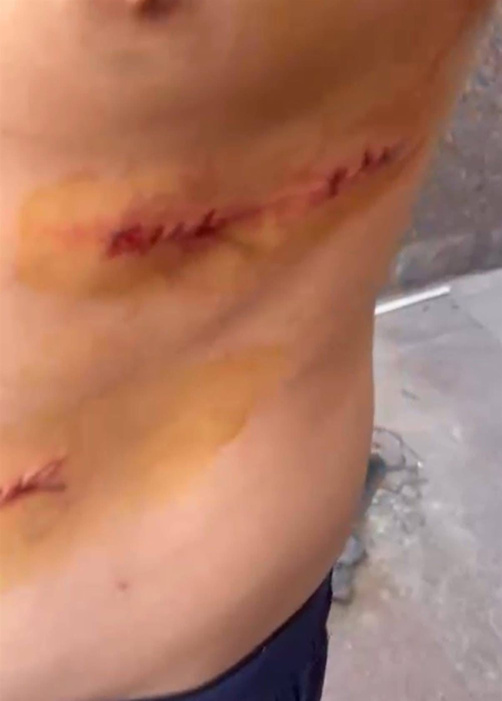 اعتداء 5 شباب على طالب ثانوي أمام مدرسته بالدقهلية&nbsp;