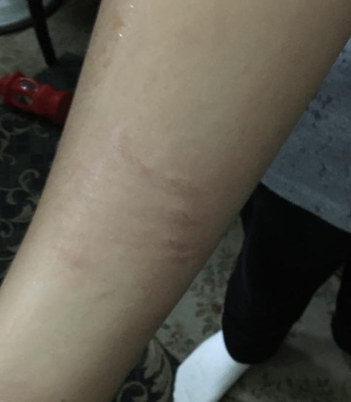 جانب من ضرب المعلمة 