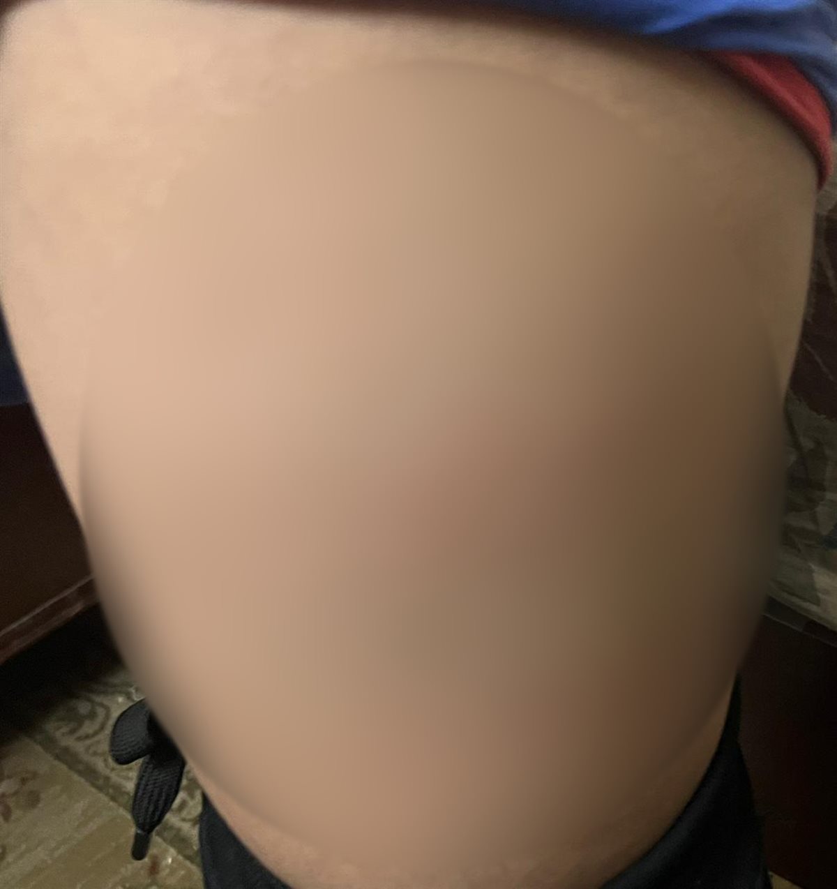 كدمات متفرقة بجسد الطالب