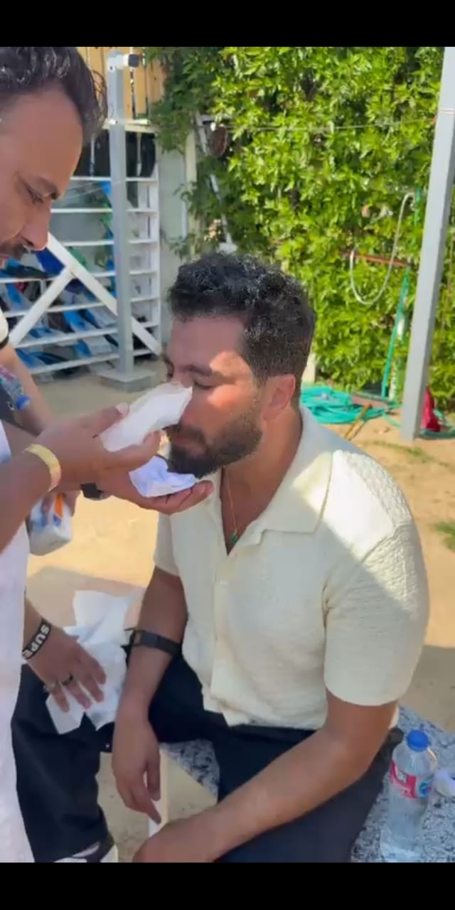 إصابة معتصم النهار خلال تصوير مشاهده بفيلم