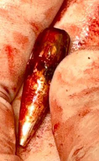 الطلقة التي تم استخراجها