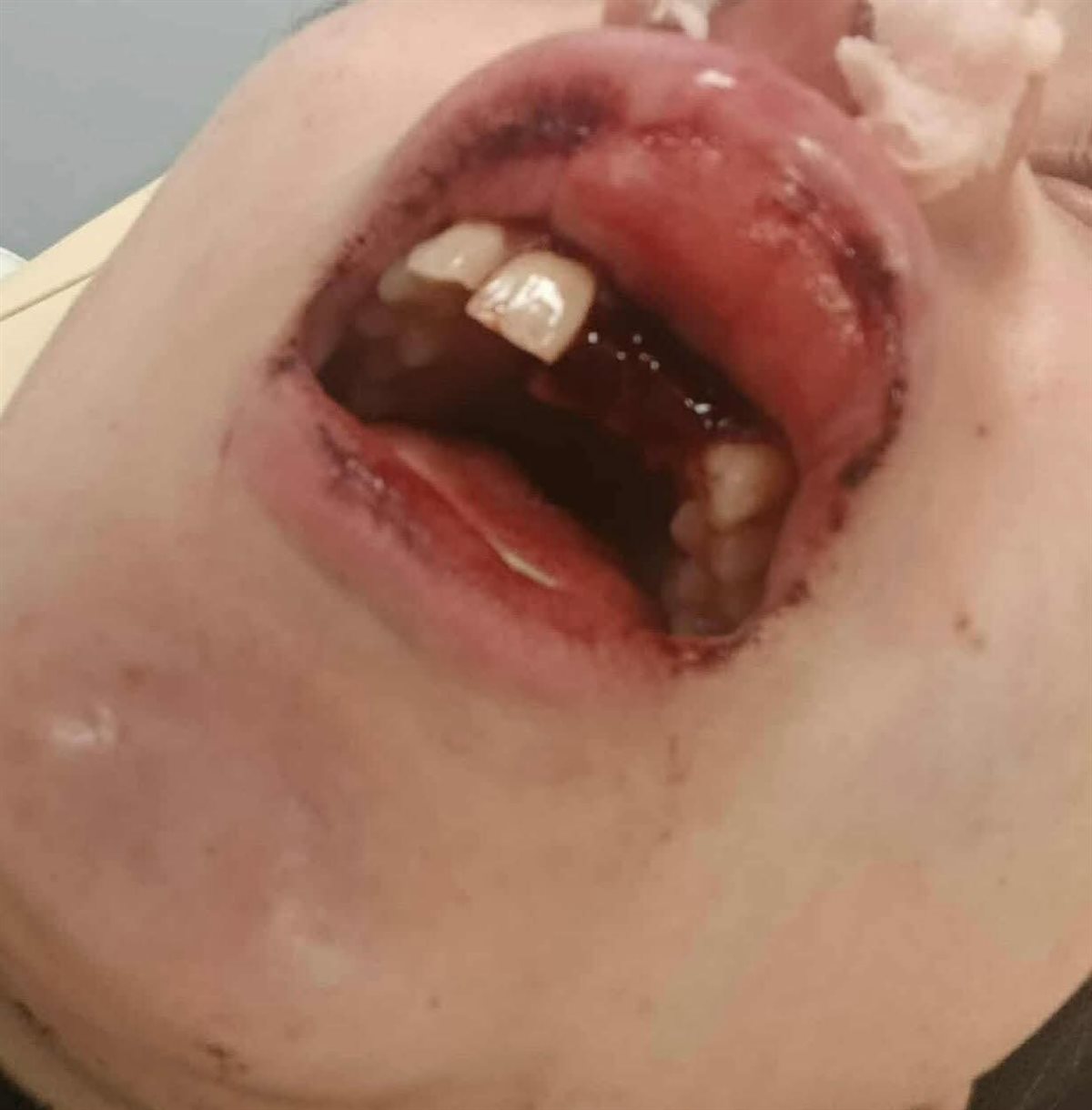 الاعتداء على سيدة ببورسعيد 