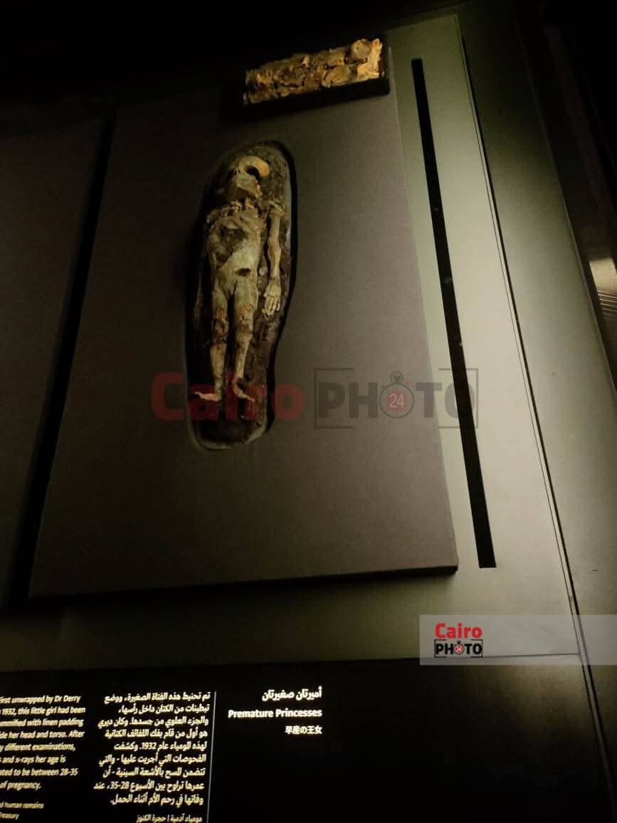 أجنة بنات توت عنخ آمون