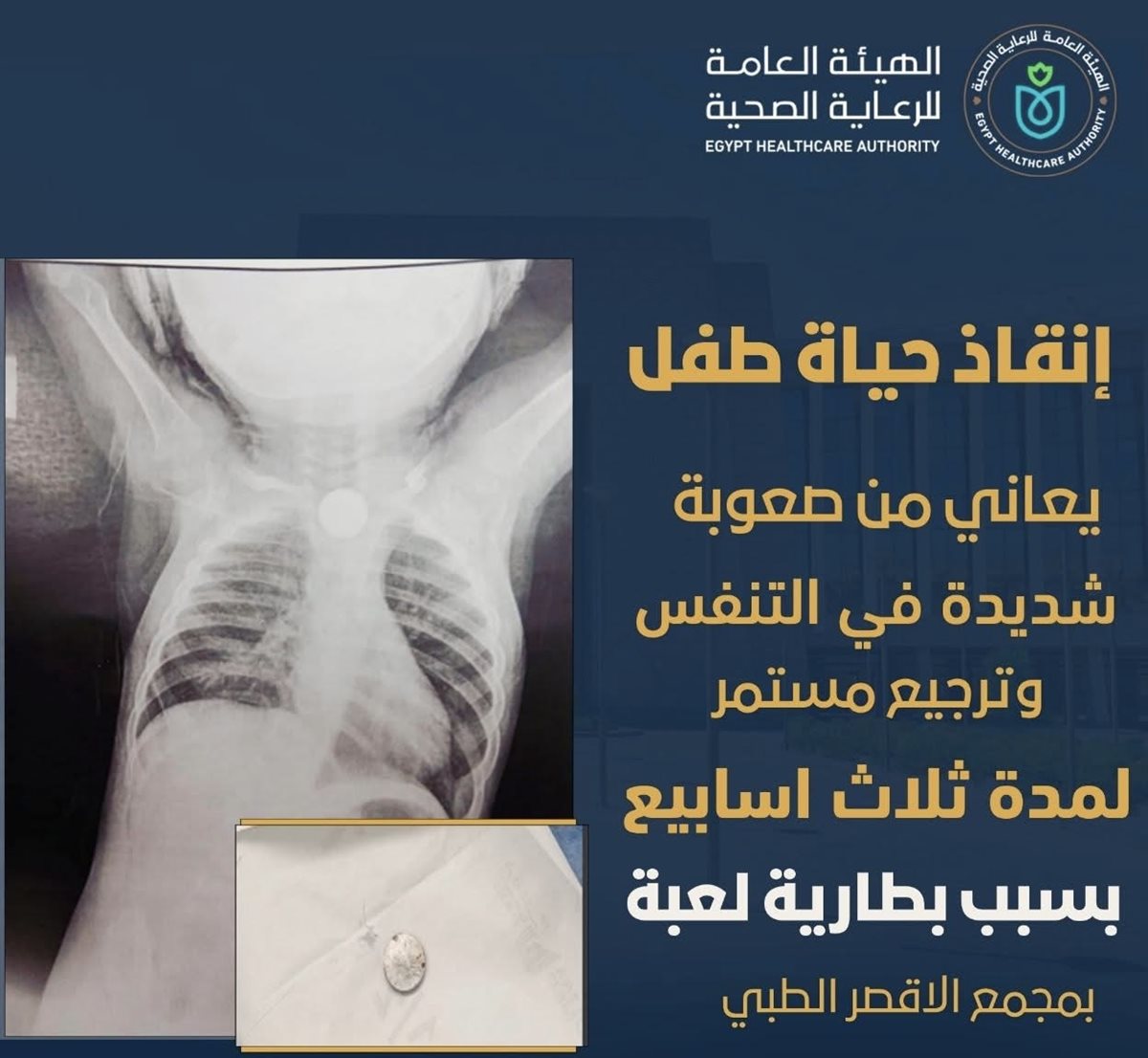 إنقاذ حياة صغير